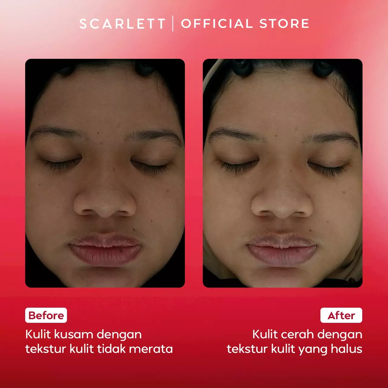 Scarlett Whitening Revive Glow Elixir Red Exfo Intensive Peeling Solution