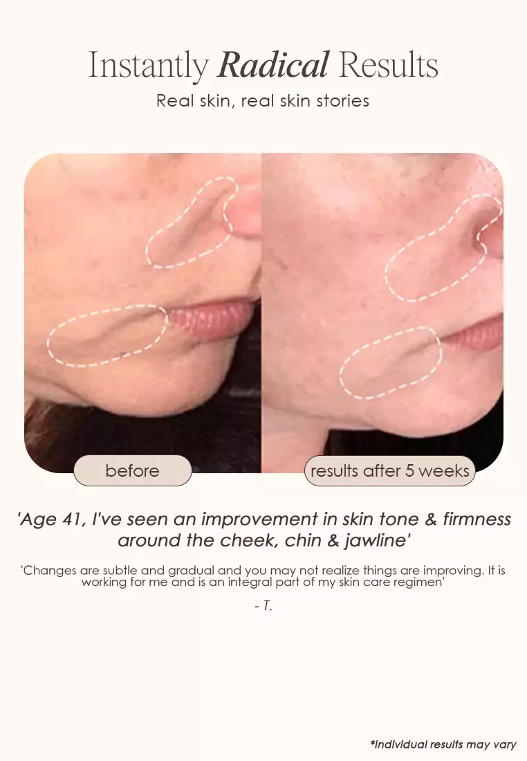 Project E Beauty 光子超聲波全效修活美顏儀