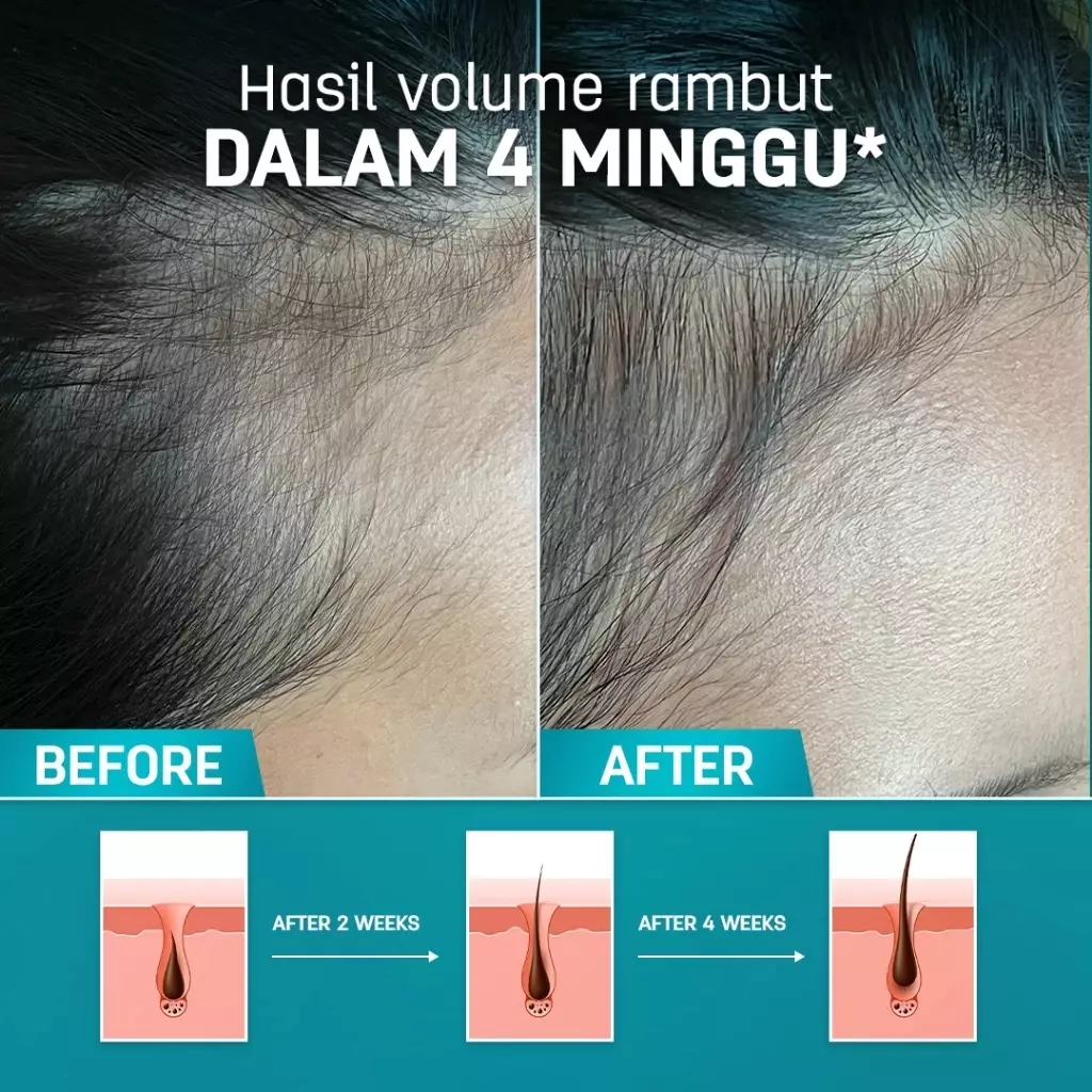 ERHAIR HairGrow Protection Serum 7x8 ml with 1.5% Kopexil - Serum Panax Ginseng Mengurangi Rontok | Serum penumbuh rambut | Menjaga Kesehatan Kulit Kepala dan Menguatkan Akar