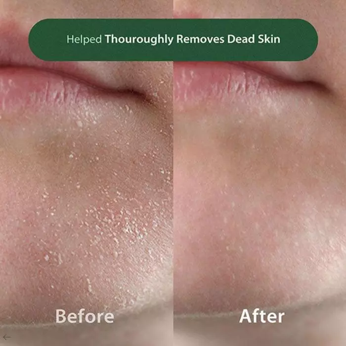 Blithe Anti-Polluaging Pore Cleansing Foam BHA 0.5 150 ml