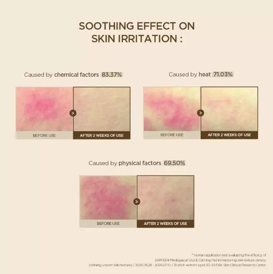 SKIN1004 Madagascar Centella Quick Calming Pad (130ml)