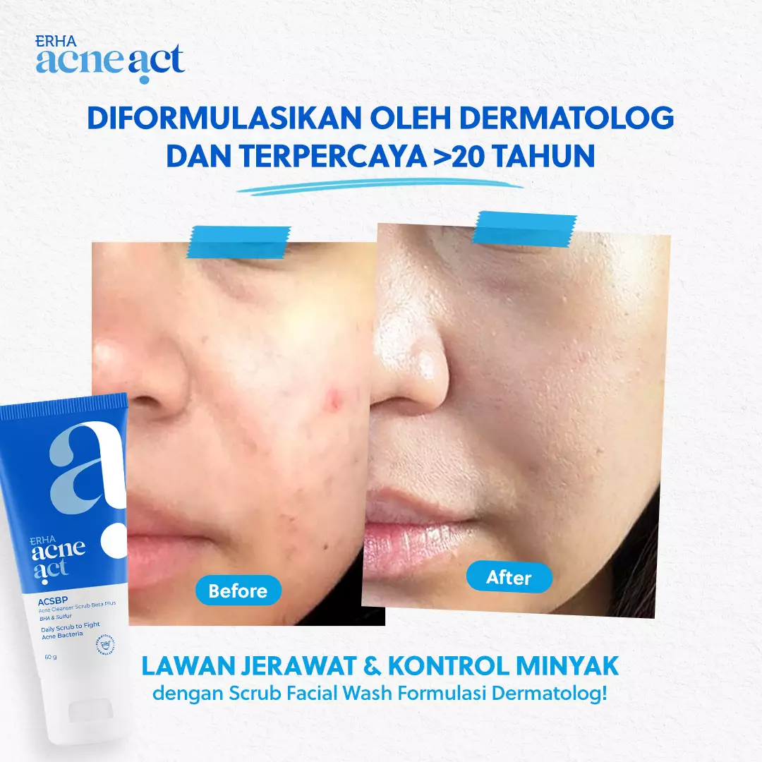 ERHA Acneact ACSBP (Acne Cleanser Scrub Beta Plus) 60g - Sabun Wajah Scrub Kulit Jerawat BHA Sulfur
