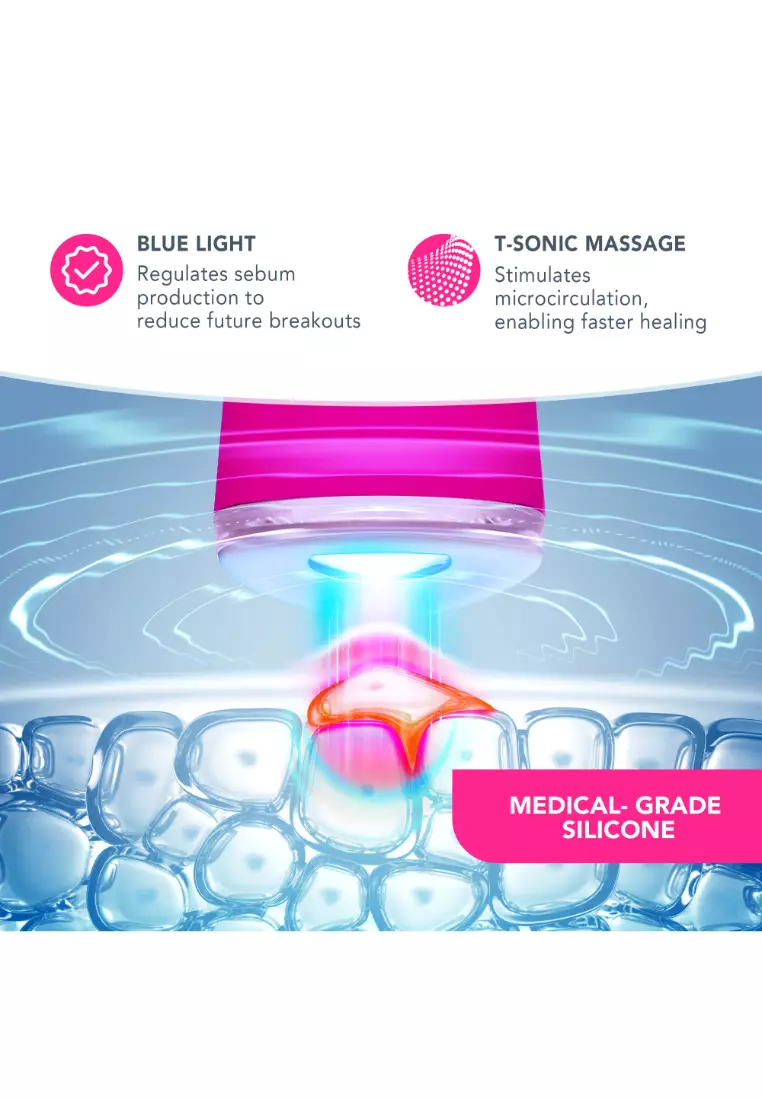 FOREO ESPADA 2 LED Light Therapy Magenta - Blemish Treatment Skincare Device | FDA cleared | Scar Treatment for Face | Pimple & Blemish Removal