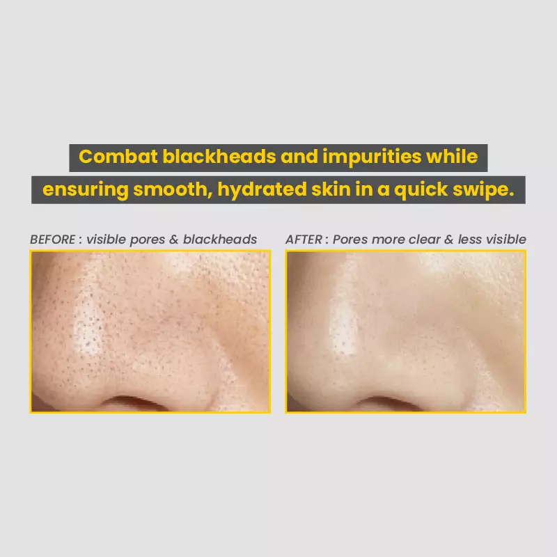 One By KOSE Clear Peel Serum - 120ml / Pore Serum