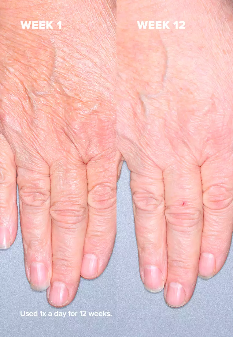 Buy Paula's Choice Phytoestrogen Elasticity Renewal Body Treatment 2024