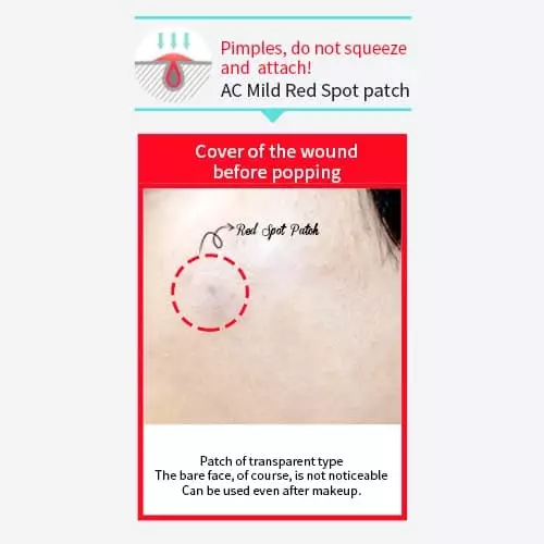 Holika Holika AC Mild Red Spot Patch