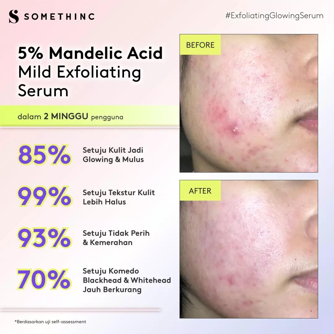 SOMETHINC 5% Mandelic Acid Mild Exfoliating Serum