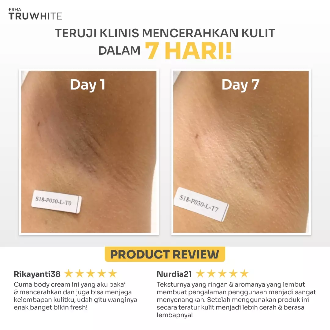 ERHA Truwhite Niacinamide & Chamomile Extract Body Brightening Cream 30G - Krim Pencerah