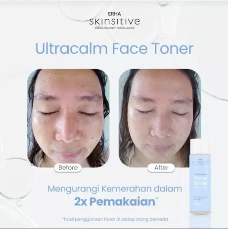 ERHA Skinsitive Ultracalm Face Toner 100g | Hydrating & Calming Toner untuk Semua Jenis Kulit (Normal - Sensitif) | Menenangkan Kulit Kering, Kemerahan, Iritasi | Skin Barrier Lebih Kuat dengan Ceramide, Niacinamide, 7 Calming Agents