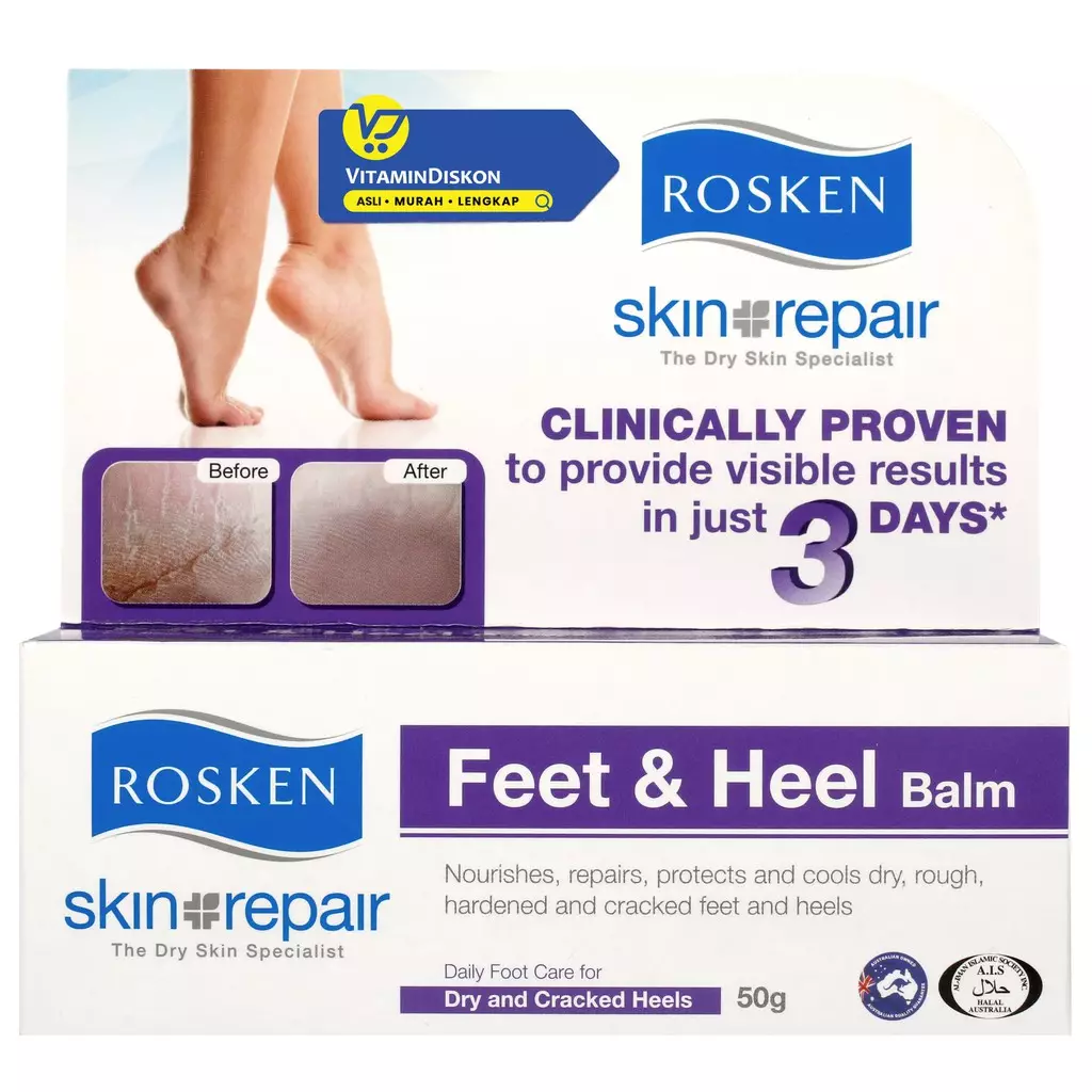 Rosken Feet Dan Heel Balm 50Gr - Pelembab Memelihara, Memperbaiki Dan Melindungi Kaki Dan Tumit