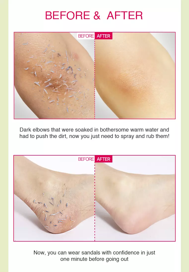 Holika Holika Baby Silky Body Exfoliating Spray | Body Peeling for Smooth & Bright Skin