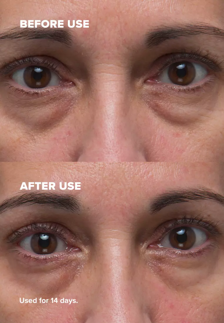 Resist Anti-Aging Eye Cream 15 ml