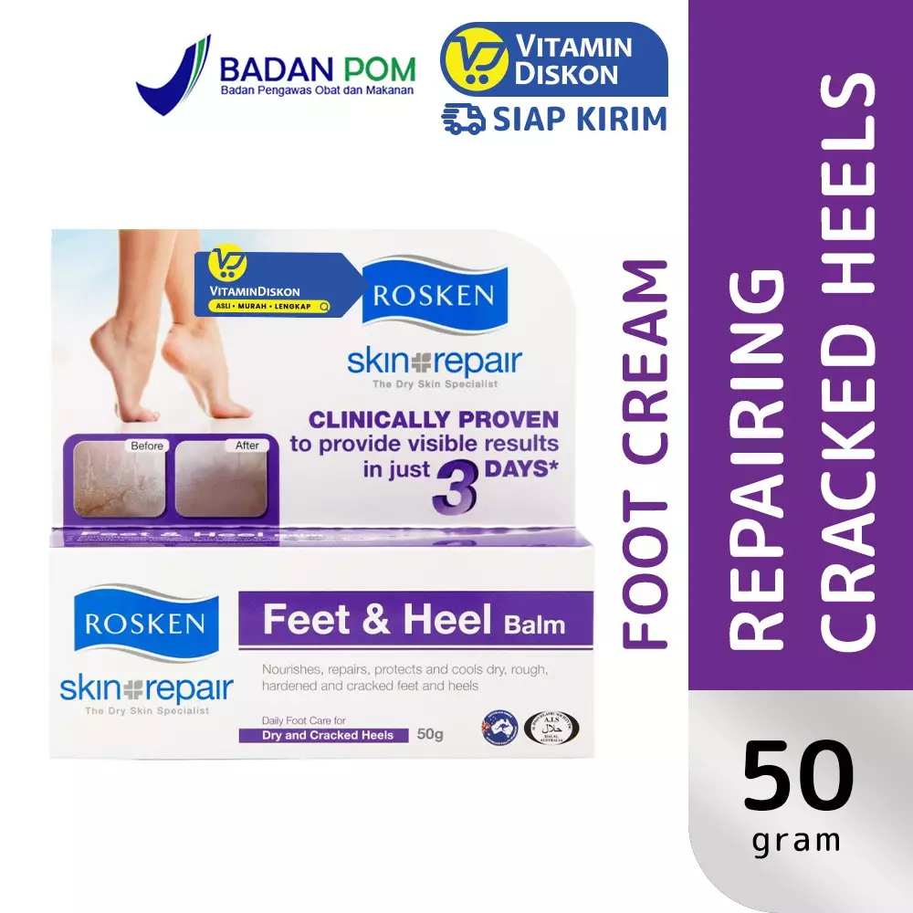 Rosken Feet Dan Heel Balm 50Gr - Pelembab Memelihara, Memperbaiki Dan Melindungi Kaki Dan Tumit