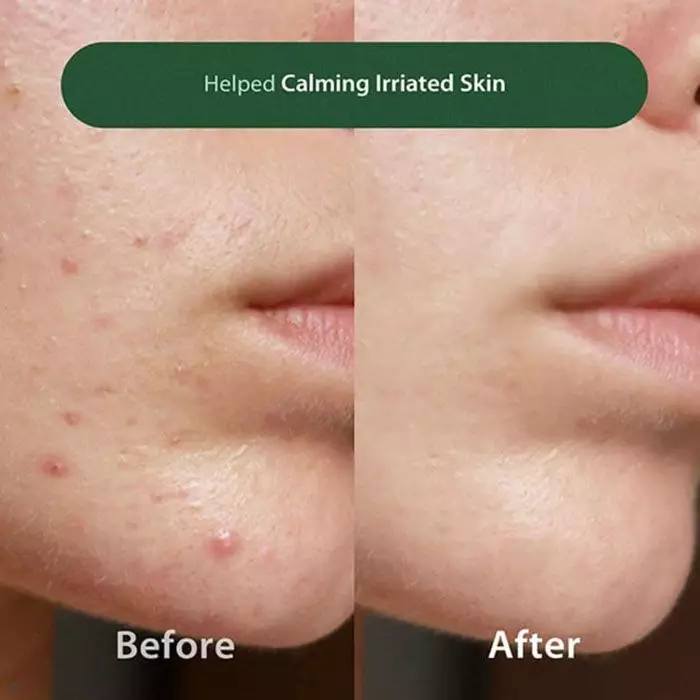 Blithe Anti-Polluaging Pore Cleansing Foam BHA 0.5 150 ml