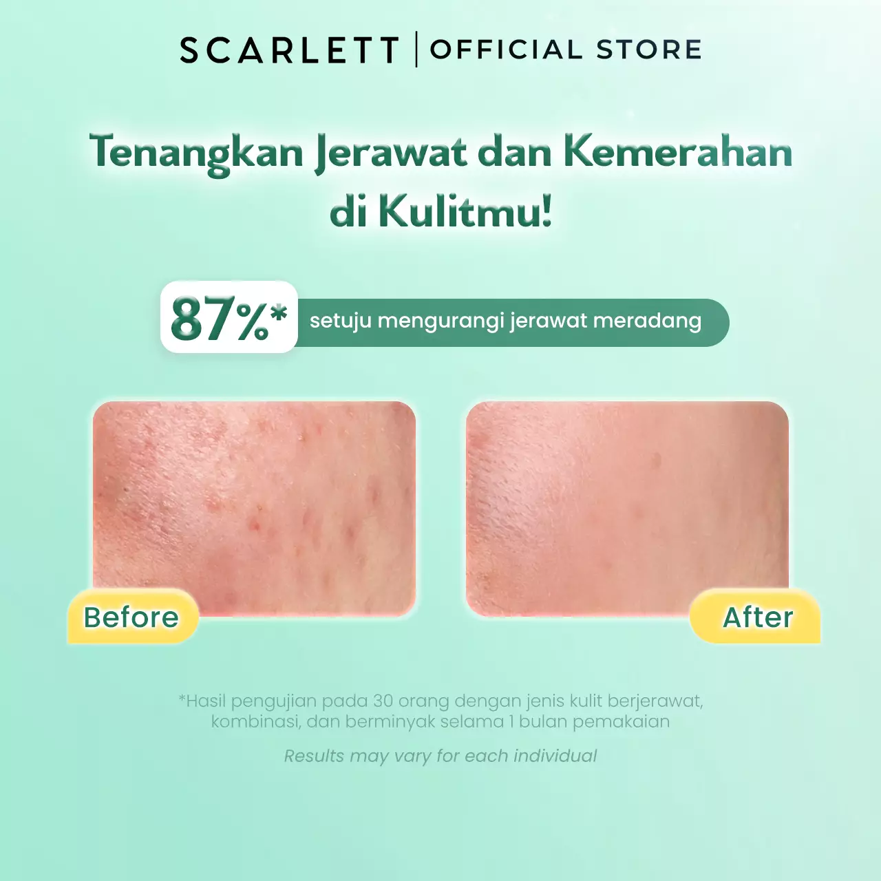 SCARLETT Low pH Acne Peace Gel Cleanser-Facial Wash Gentle Sabun Cuci Muka Low pH, Kulit Tidak Ketarik, Basic Skincare Anti Jerawat, Aman Untuk Kulit Sensitif Aman untuk Skin Barrier, Untuk Kulit Berjerawat dan Berminyak, Membersihkan Kotoran dan Minyak