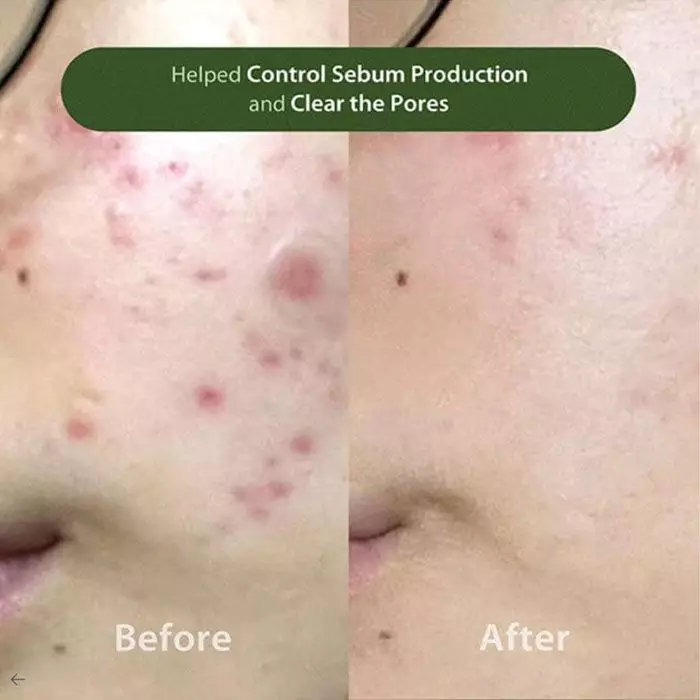 Blithe Anti-Polluaging Pore Cleansing Foam BHA 0.5 150 ml