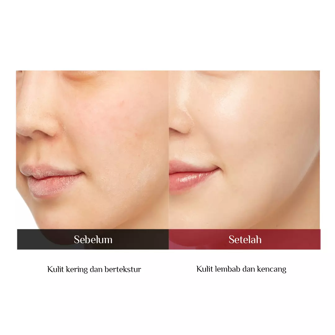 Holika Holika Enprani Retino X8 Pro Deep Wrinkle Skin Softener - Toner Anti Aging