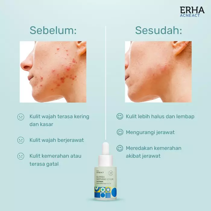 ERHA Acneact Blemish Soothing Serum 30 ml - Serum untuk Kulit Kering Berjerawat | Cica | Prebiotic