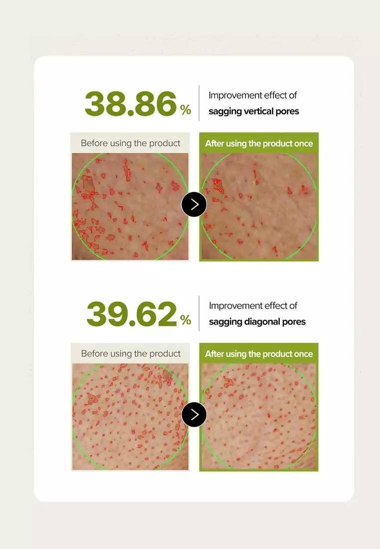 SKINFOOD RICE BRIGHTENING CREAM | Gel Moisturizer Rice Ferment Niacinamide Peptide Brightening Hydrating