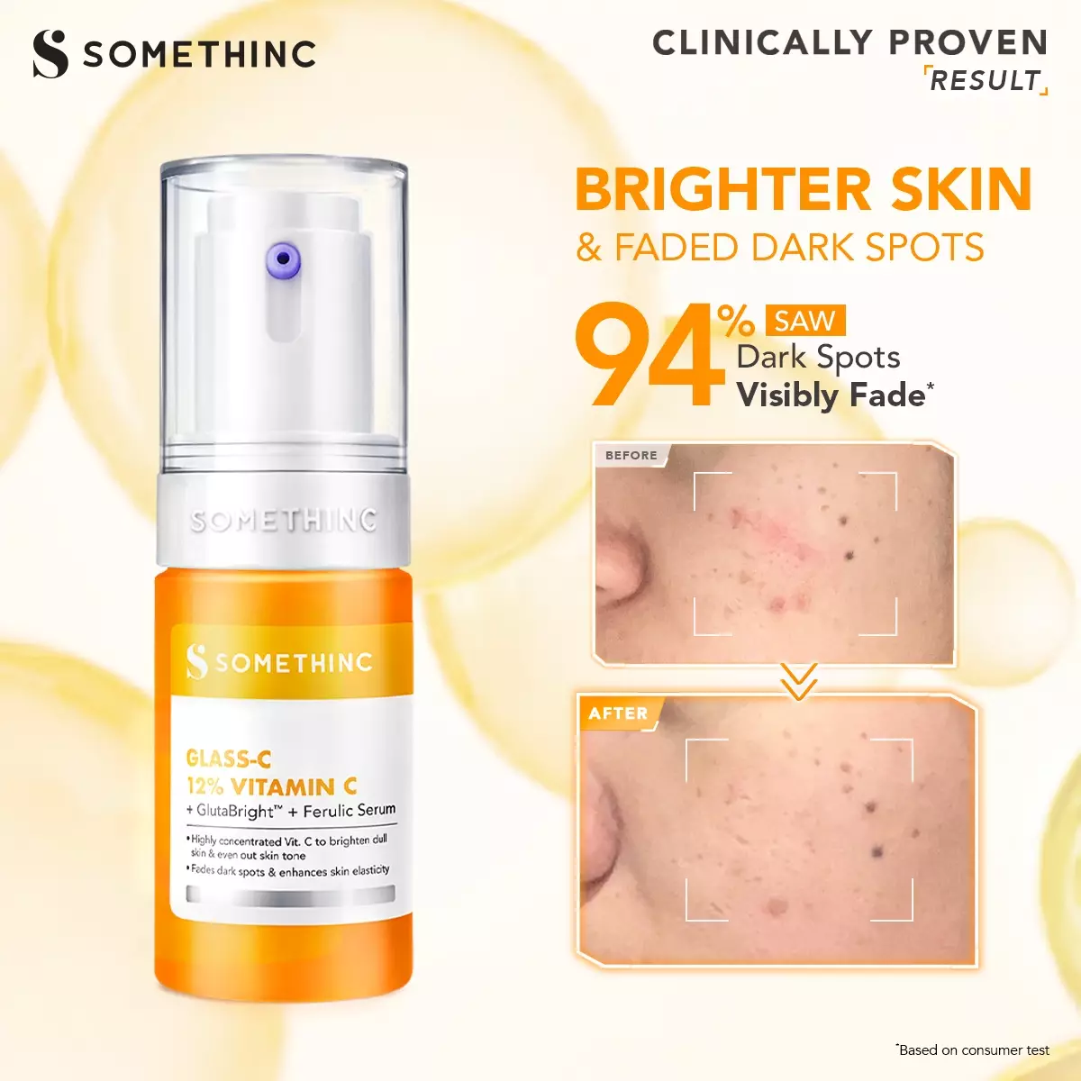 [BARU!] SOMETHINC Glass-C 12% Vitamin C+ GlutaBright™ + Ferulic Serum 20ml