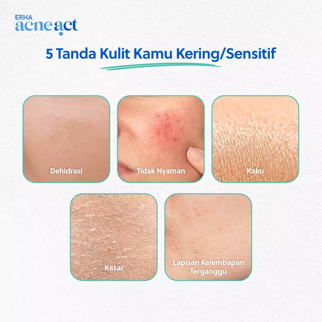 ERHA Acneact Low Ph Gentle Facial Wash 100g - Sabun Wajah Jerawat Kulit Sensitif  Ph Balance Low ph