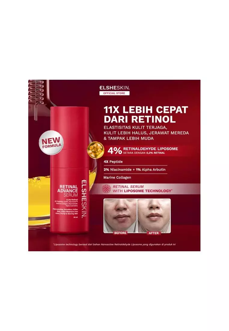 Jual ElsheSkin Elsheskin Retinal Advance Serum (20ml) Original 2026 ...
