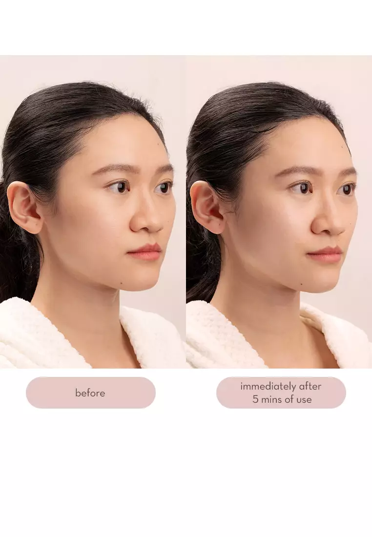 Face Sculpting Microcurrent Device