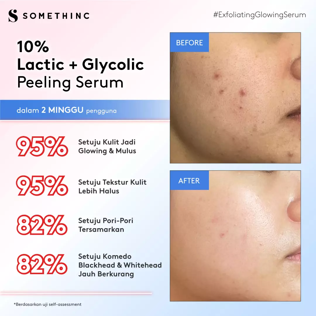 SOMETHINC 10% Lactic + Glycolic Peeling Serum