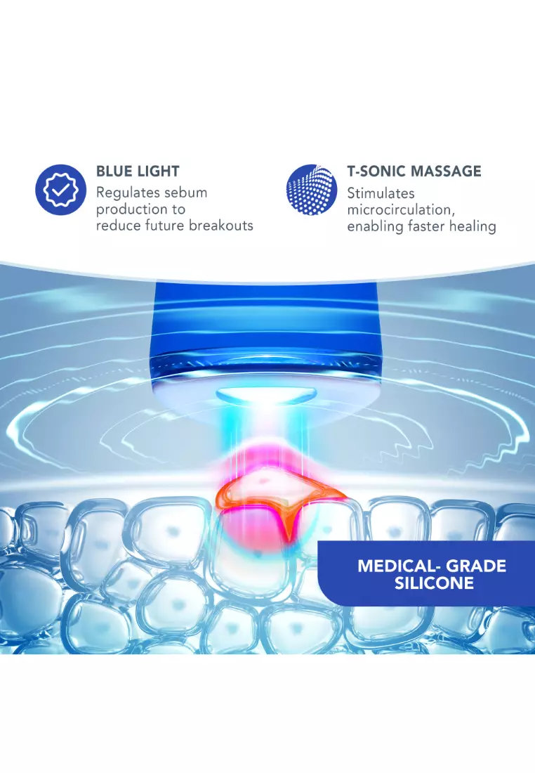 FOREO ESPADA 2 LED Light Therapy Cobalt Blue - Blemish Treatment Skincare Device | FDA cleared | Scar Treatment for Face | Pimple & Blemish Removal