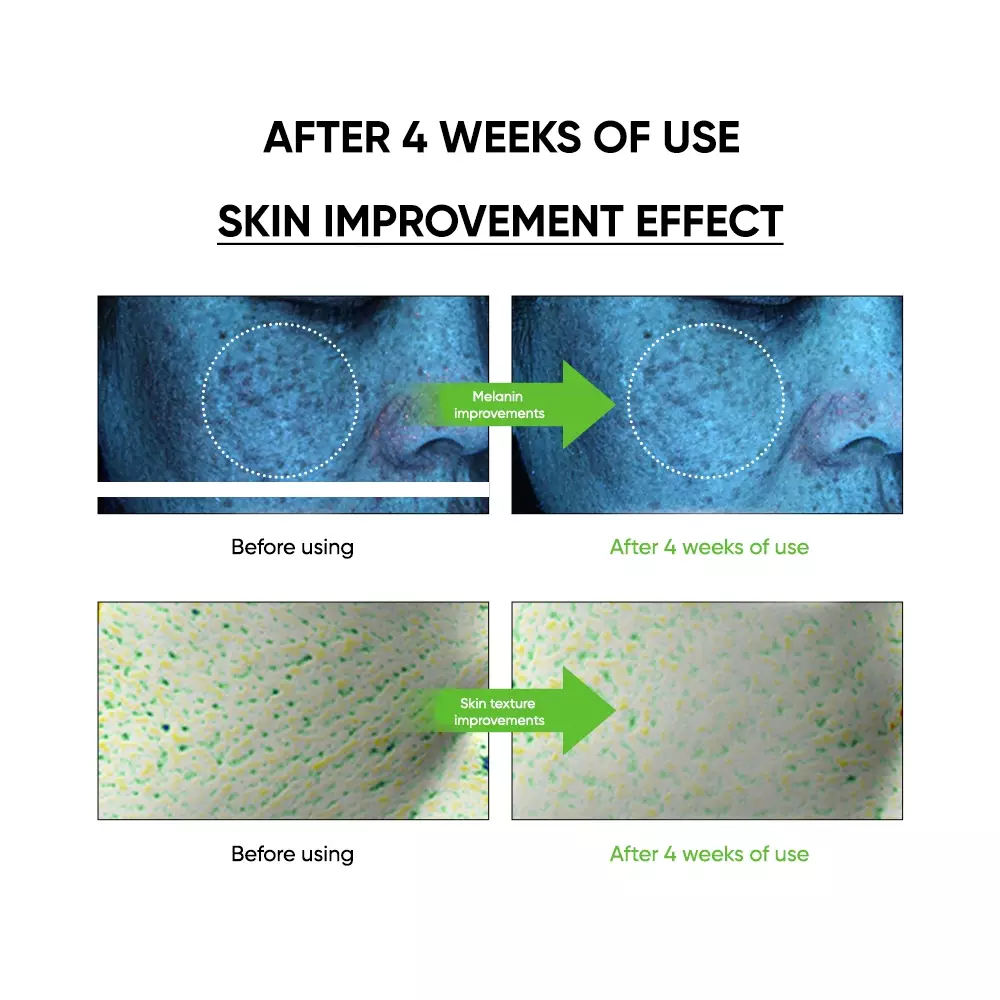 Vitapair C Dark Spot Serum Large 90ml