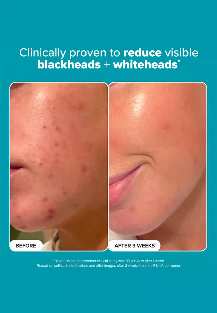 Skin Perfecting 2% BHA (Salicylic Acid) Liquid 118 ml