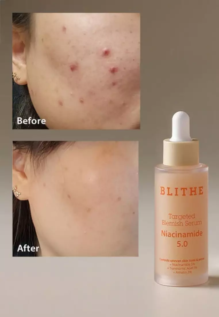 Blithe Targeted Blemish Serum Niacinamide 30 ml