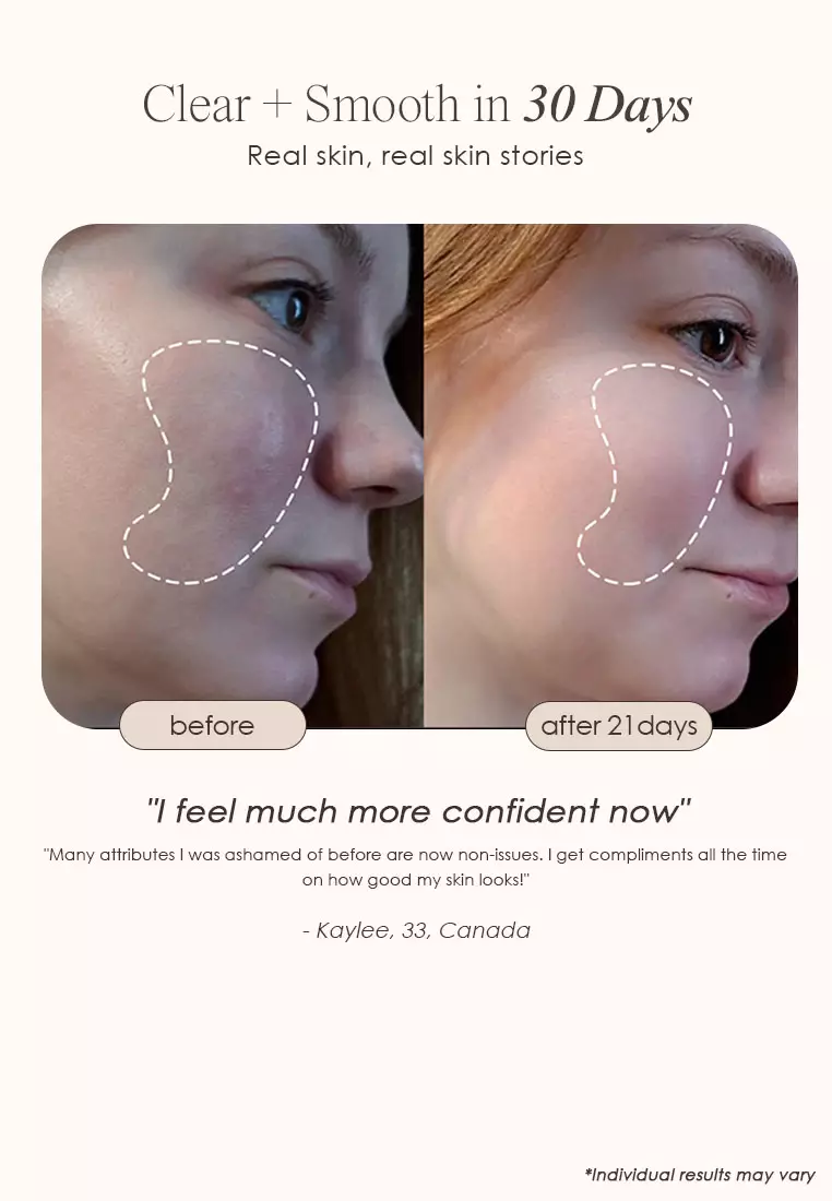 Project E Beauty Faisca Neon & Argon High Frequency Wand