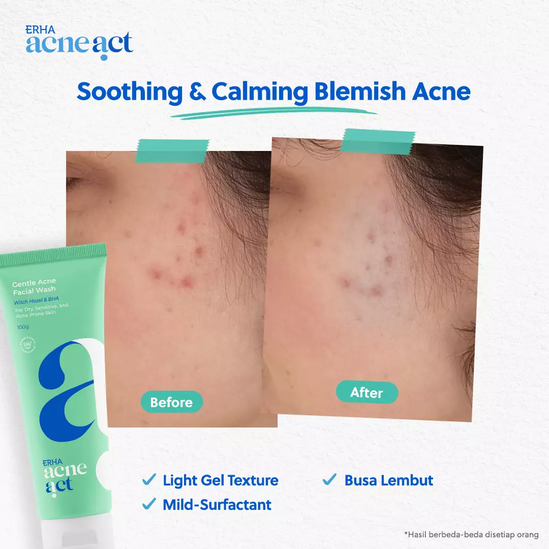 ERHA Acneact Bundle Cleanse + Protect  | Combo Sunscreen SPF 45 Niacinamide + Sabun Cuci Muka low ph