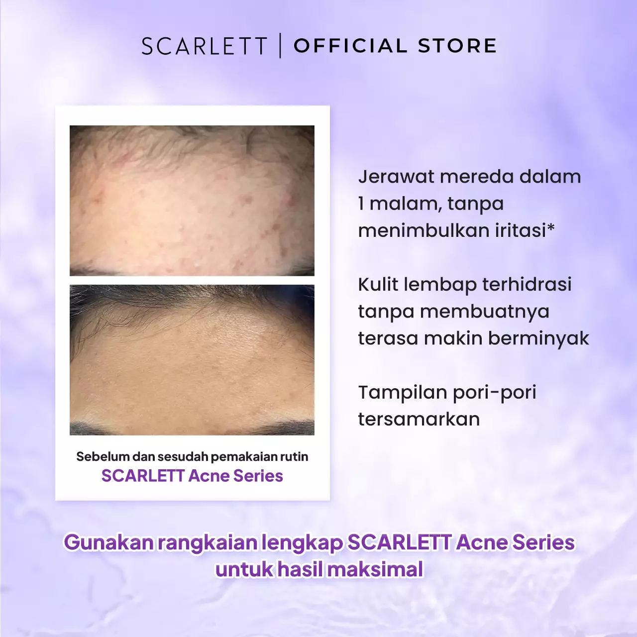 Scarlett Whitening Acne Night Cream