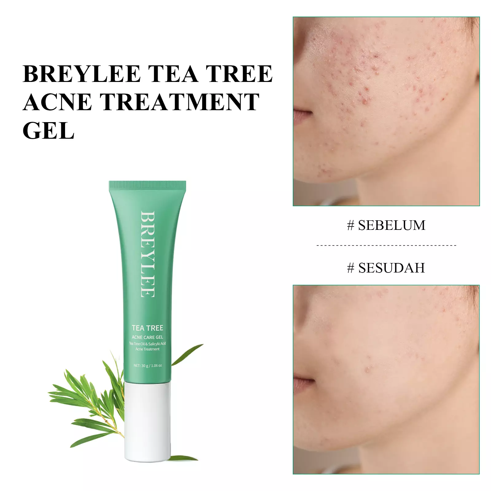 [BPOM] BREYLEE Tea Tree Acne Care Gel