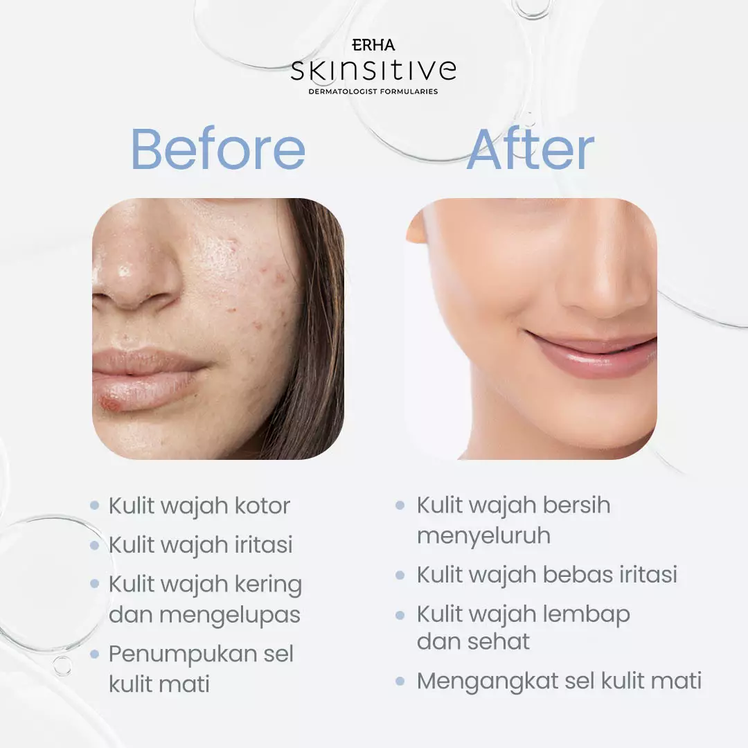 ERHA Skinsitive Ultracalm Face Wash 80g | Sabun Cuci Muka Semua Jenis Kulit (Normal - Sensitif) dengan Panthenol, Aloe Vera Extract | Melembapkan, Kulit Tidak Ketarik | PH Balance, Hypoallergenic, Gentle, Calming | Memperkuat Skin Barrier