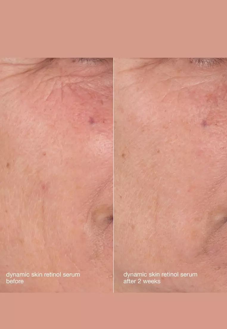 [value set] skin aging solutions kit, retexturizes, moisturizes, repairs