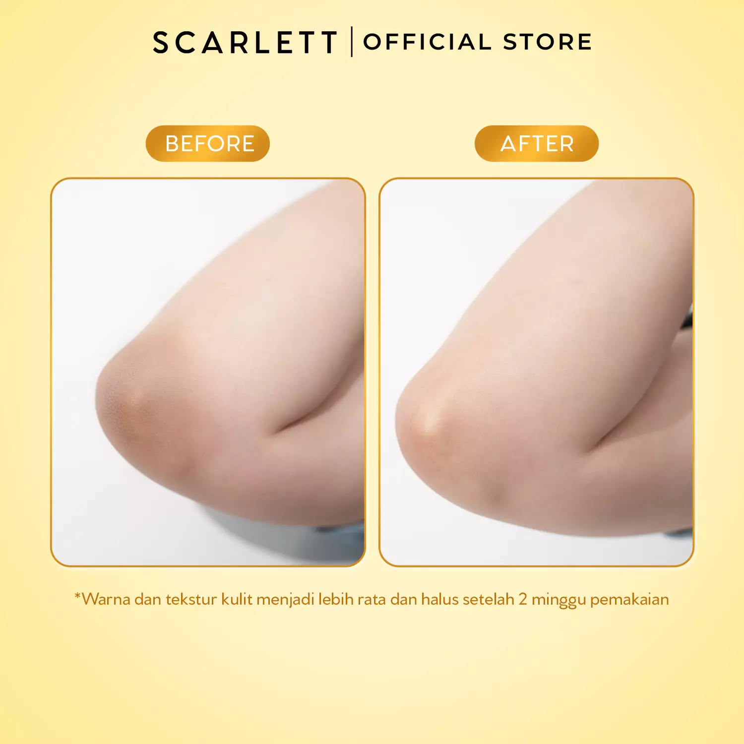 [NEW LAUNCH] SCARLETT Intense Brightening AHA Body Booster 10% AHA BHA PHA PRO-WHITE