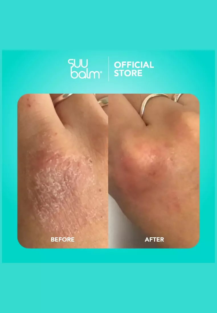 Ceramide Moisturiser Rapid Itch Relief 75ML