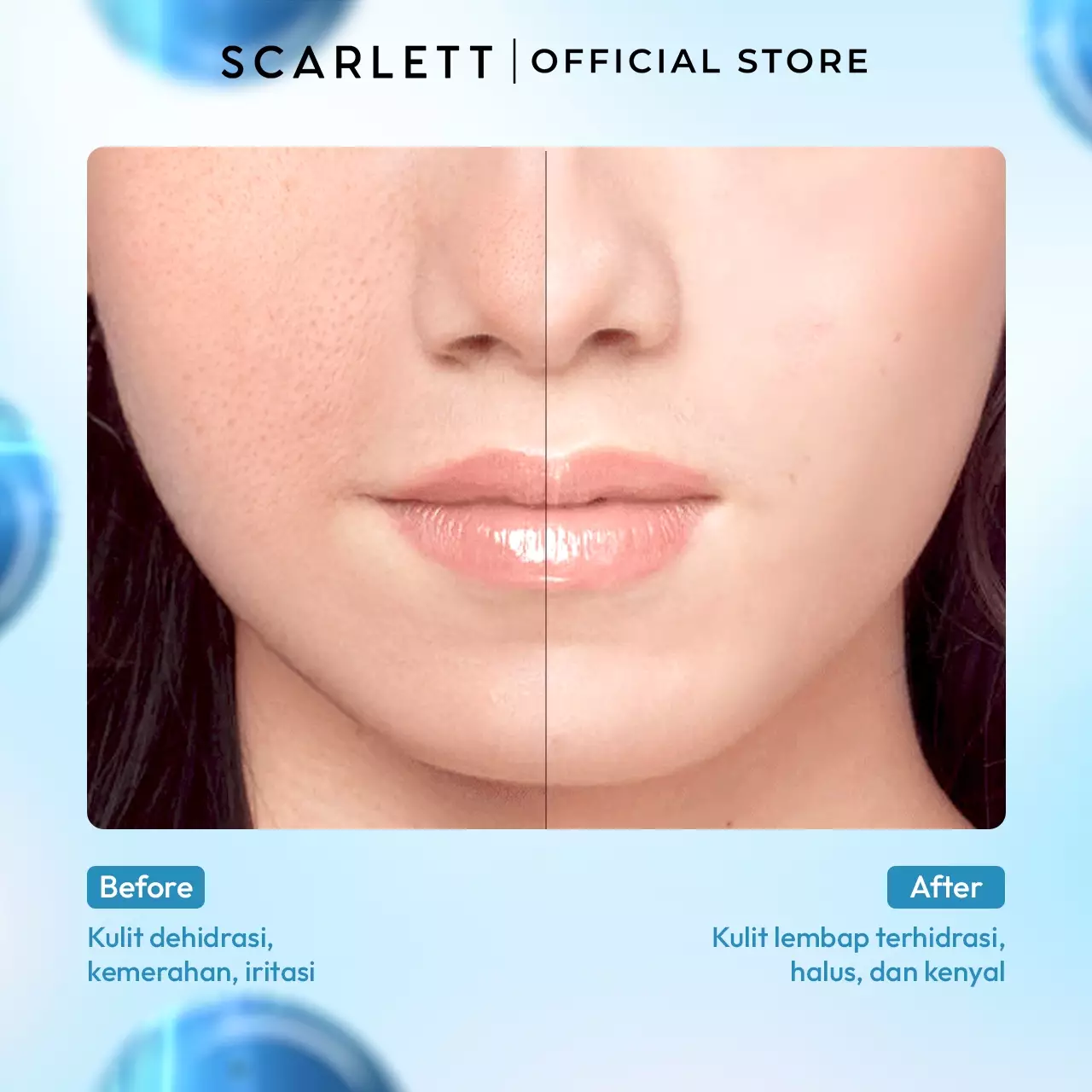 Scarlett Whitening Blue Hydra Intensive Calming Solution
