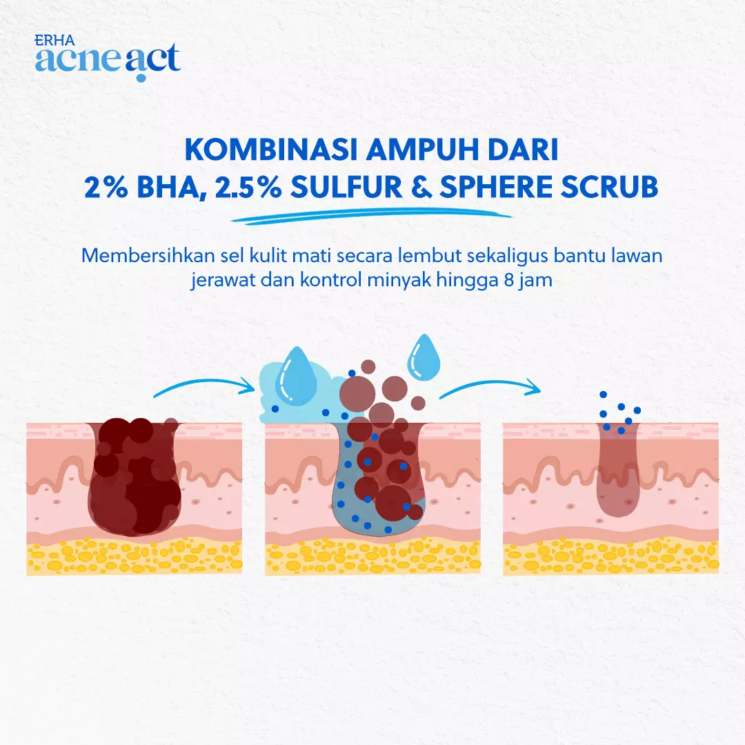 ERHA Acneact ACSBP (Acne Cleanser Scrub Beta Plus) 60g - Sabun Wajah Scrub Kulit Jerawat BHA Sulfur