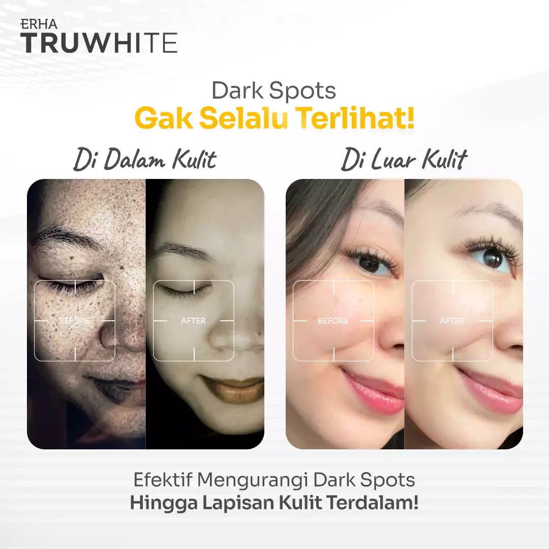 ERHA Truwhite 3% Txa & Hexyl Resorcinol Active Glow Booster 15Ml - Booster Pencerah