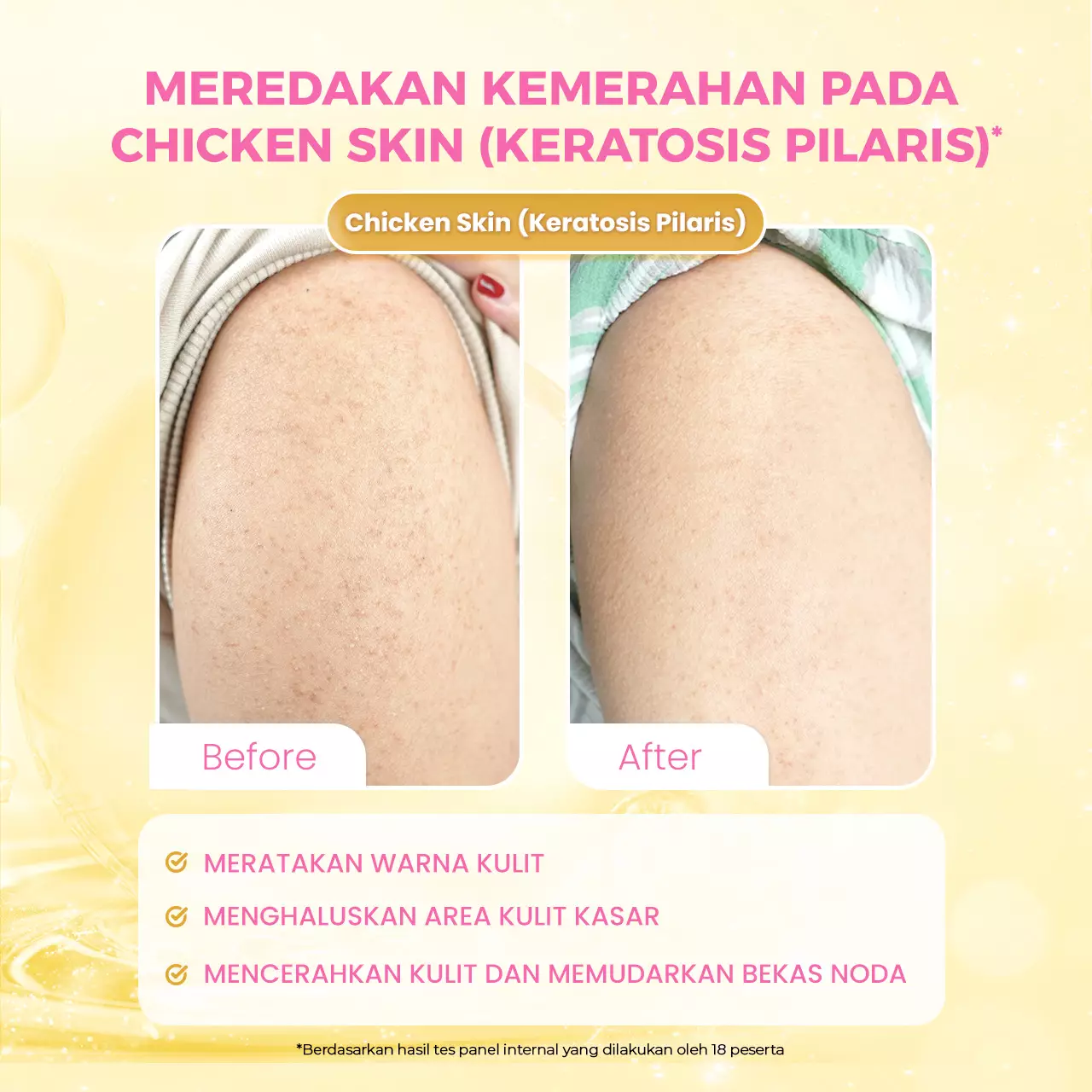 Scarlett Whitening Intense Brightening AHA Body Serum 5% AHA BHA PHA