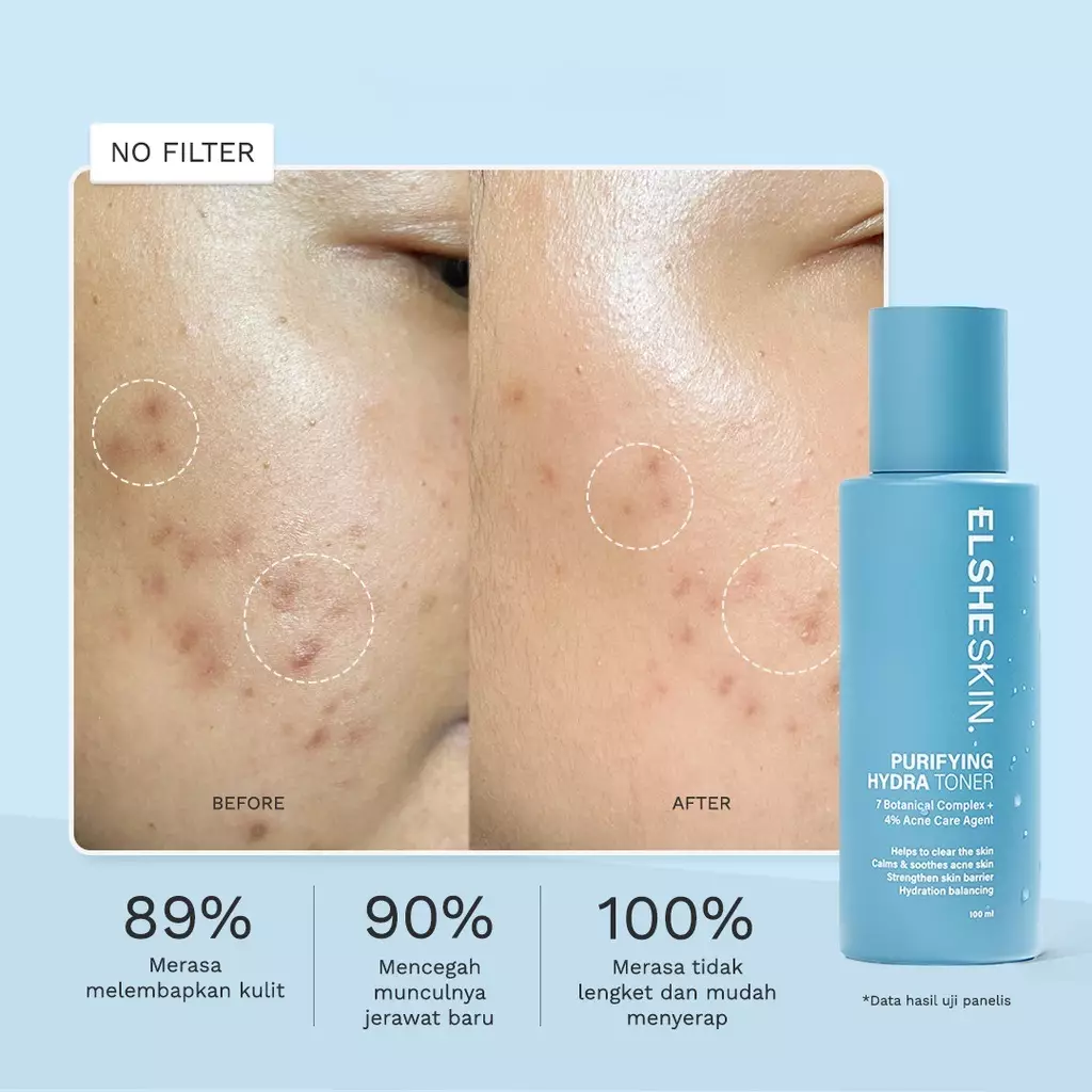 ElsheSkin Purifying Hydra Toner 100ml