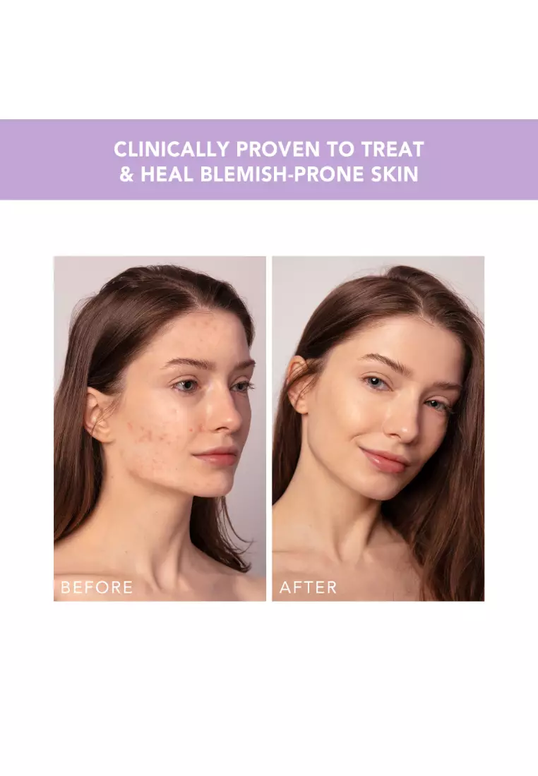 FOREO ESPADA 2 Plus Pistachio Precise Targeting LED Light Therapy - Skin Care Device for Blemish Treatment | FDA cleared | Scar & Spot Treatment for Face