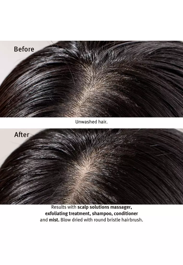 Scalp Solutions Overnight Scalp Renewal Serum 50ml