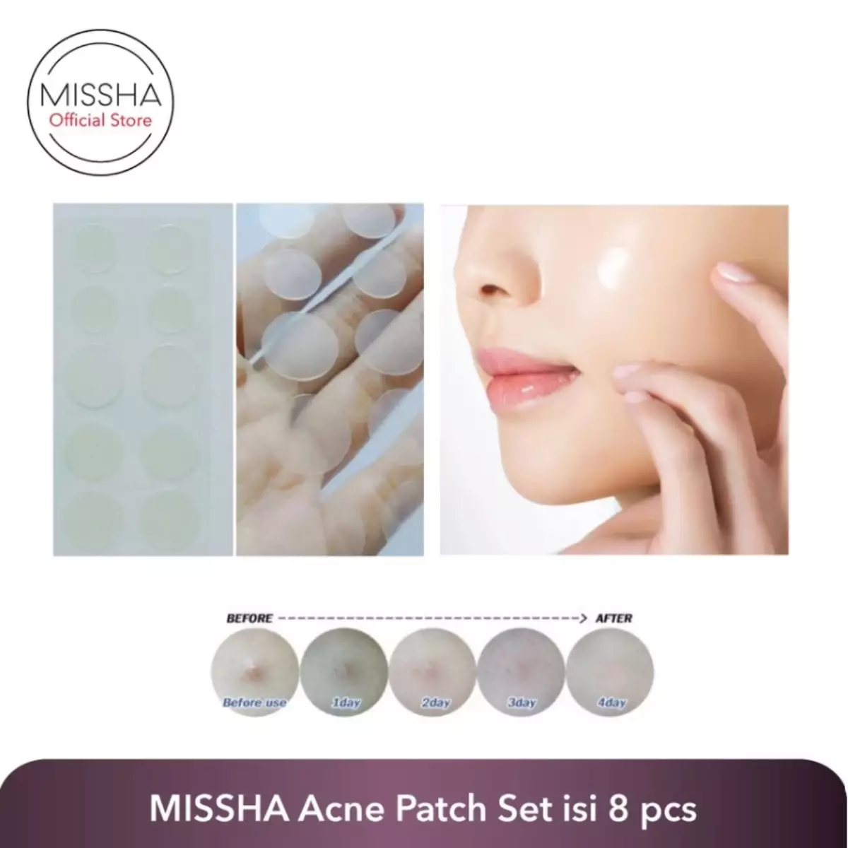 Missha Acne Patch Set (isi 8pcs per box)