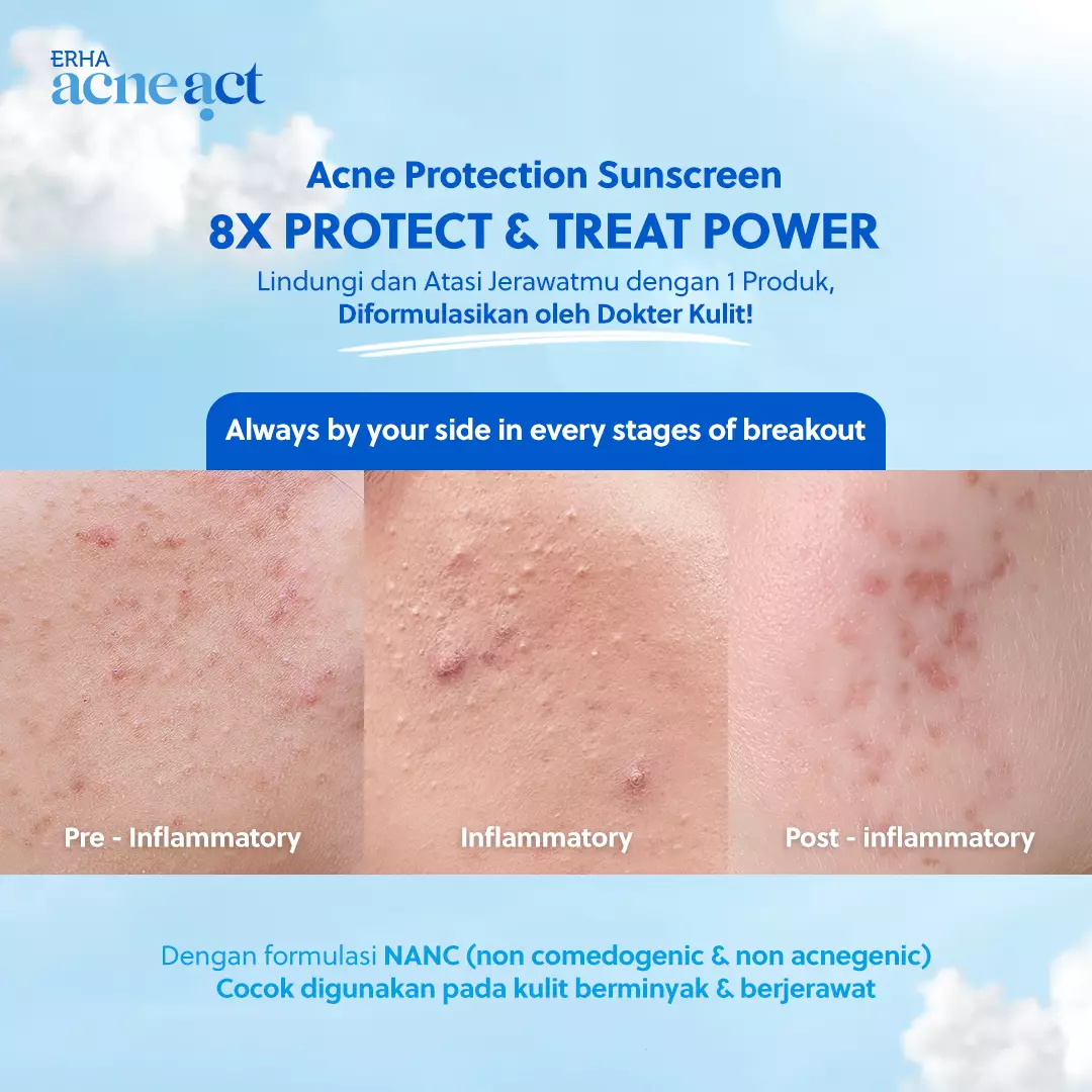 ERHA Acneact Acne Protection & Oil Control Sunscreen SPF 45+++ 30 g Sunscreen Jerawat Niacinamide