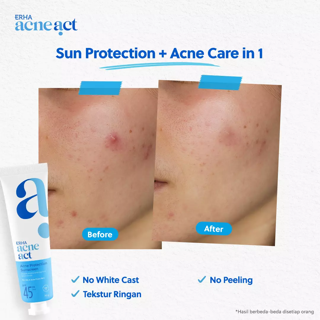 ERHA Acneact Bundle Cleanse + Protect  | Combo Sunscreen SPF 45 Niacinamide + Sabun Cuci Muka low ph